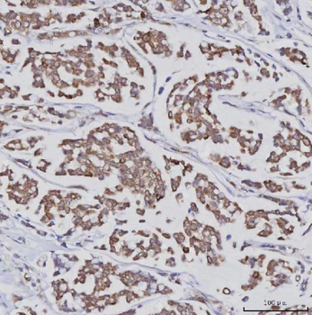 Anti-PLXDC2 Antibody