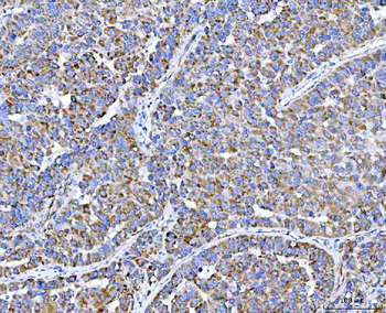Anti-PLXDC2 Antibody