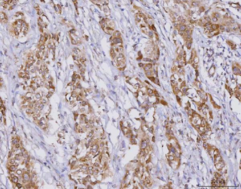 Anti-PLXDC2 Antibody
