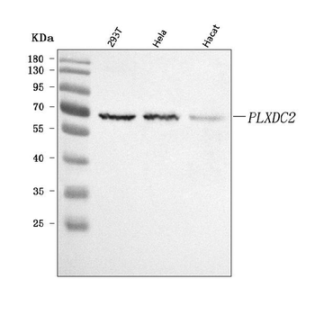 Anti-PLXDC2 Antibody