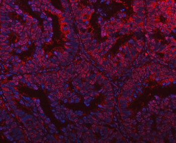 Anti-PLEKHG5 Antibody