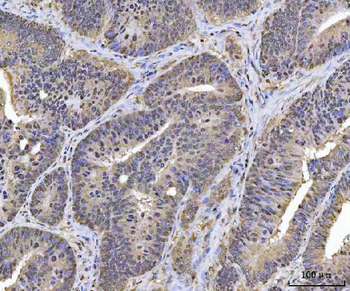 Anti-PLEKHG5 Antibody