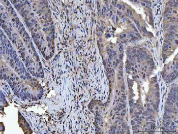 Anti-PLEKHG5 Antibody