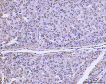 Anti-PLEKHG5 Antibody