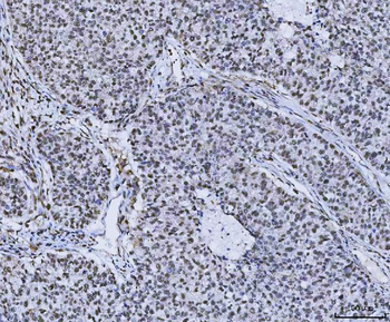 Anti-PLEKHG5 Antibody