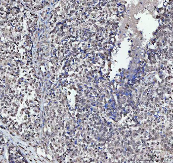 Anti-PLEKHG5 Antibody