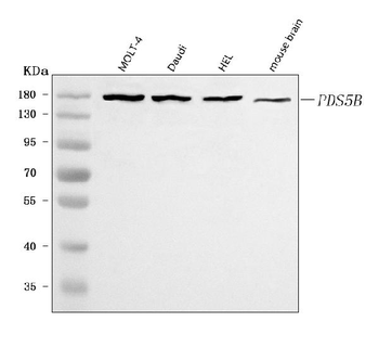 Anti-PDS5B Antibody