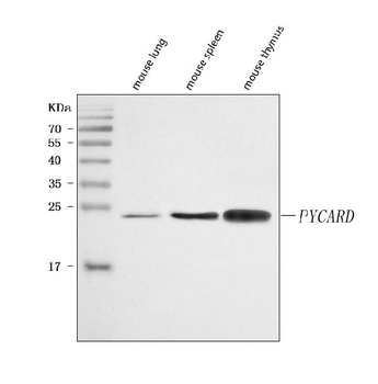 Anti-ASC/TMS1/Pycard Antibody