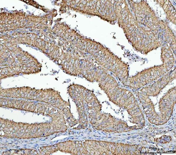 Anti-RPS13 Antibody