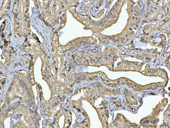 Anti-RPS13 Antibody