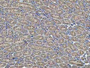 Anti-Renin/REN Antibody