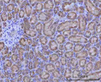 Anti-Renin/REN Antibody
