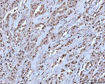 Anti-RBM15 Antibody