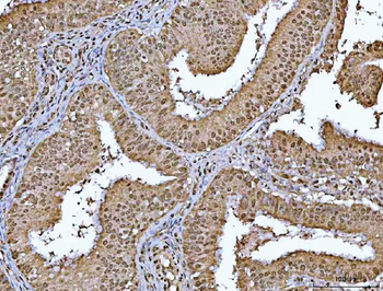 Anti-RBM15 Antibody