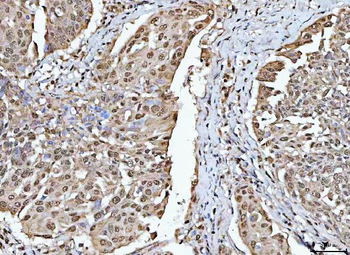Anti-RBM15 Antibody