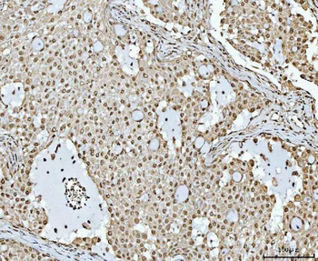 Anti-RBM15 Antibody