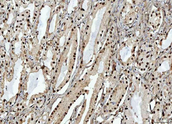 Anti-RBM15 Antibody