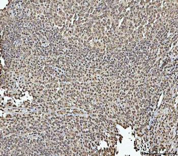 Anti-RBM15 Antibody