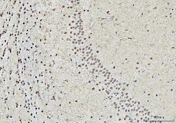 Anti-RBM15 Antibody