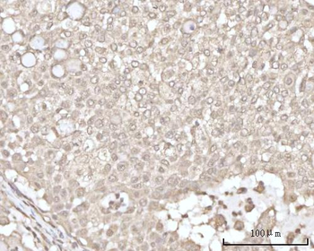 Anti-Recoverin/RCVRN Antibody