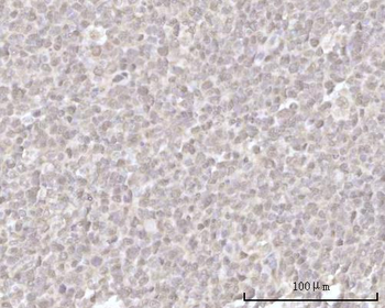 Anti-Recoverin/RCVRN Antibody