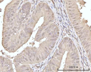 Anti-Recoverin/RCVRN Antibody
