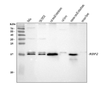 RBP2 Rabbit Polyclonal Antibody