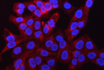 Anti-RAB39A/B Antibody