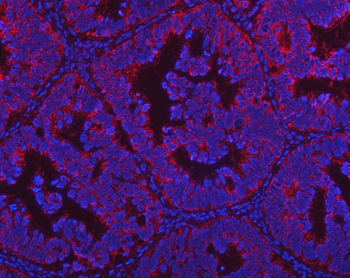 Anti-PGP Antibody