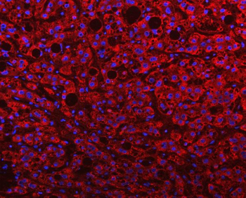 Anti-PGP Antibody