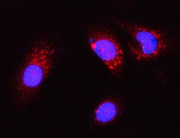 Anti-PGP Antibody