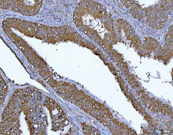Anti-PGP Antibody