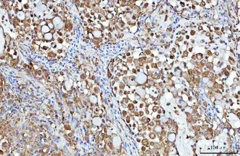 Anti-PGP Antibody