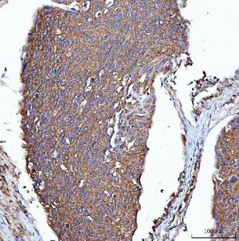 Anti-PGP Antibody