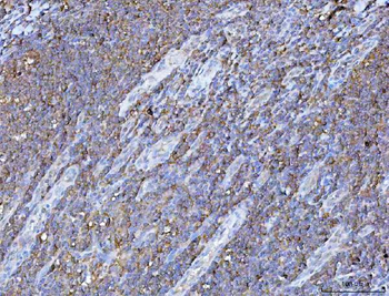 Anti-PGP Antibody