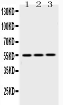 Anti-Caspase 8/CASP8 Antibody