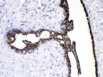 Anti-Caspase 8/CASP8 Antibody
