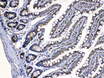 Anti-Caspase 8/CASP8 Antibody