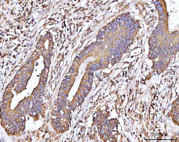 Anti-MICALL2 Antibody
