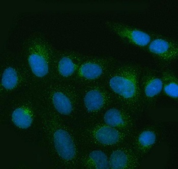 Anti-MIA3 Antibody