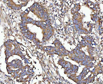 Anti-MIA3 Antibody