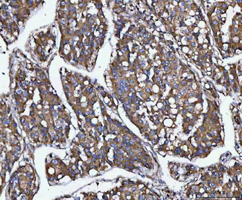 Anti-MIA3 Antibody