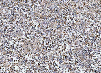 Anti-MIA3 Antibody