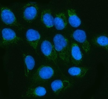 Anti-MGME1 Antibody