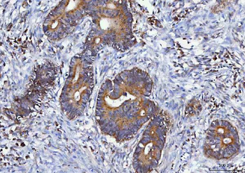 Anti-MGME1 Antibody