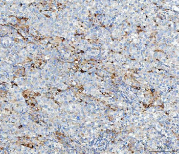 Anti-MGME1 Antibody