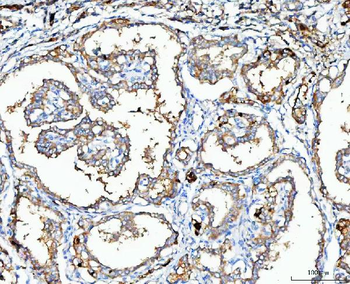 Anti-MGME1 Antibody