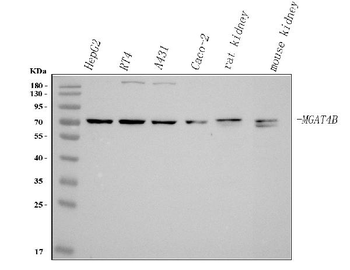 Anti-MGAT4B Antibody