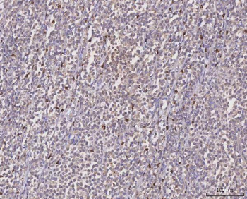 Anti-MGAT2 Antibody