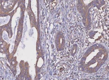 Anti-MGAT2 Antibody